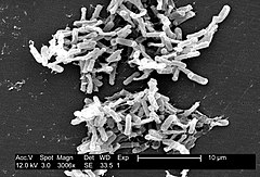 SEM-bild av Clostridium difficile-kolonier.