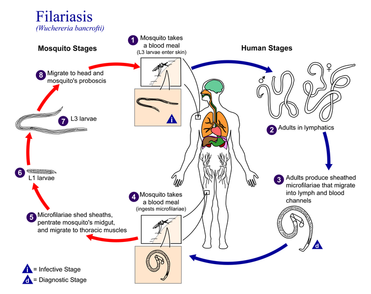 Fil:Filariasis 01.png