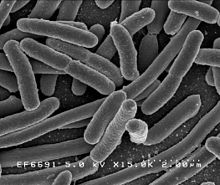 Escherichia coli, 25 000 ggr förstoring