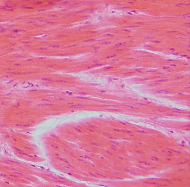 Fil:Glatte Muskelzellen.jpg