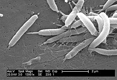 Scanning electron micrograph of Helicobacter bacteria.