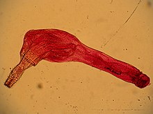Corynosoma wegeneri
