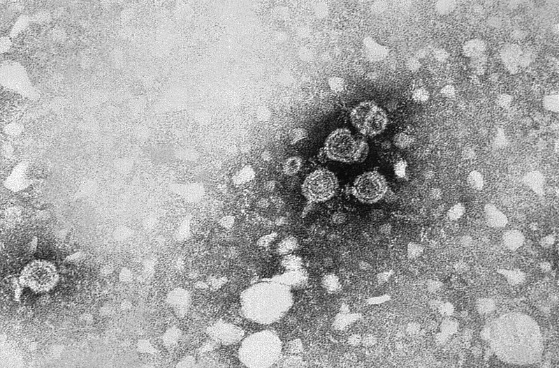 Fil:Hepatitis B virus 01.jpg