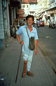 En man med förtvinat ben till följd av polioinfektion.