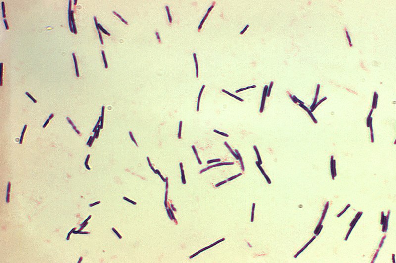 Fil:Clostridium perfringens.jpg