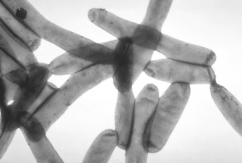 Fil:Legionella pneumophila 01.jpg