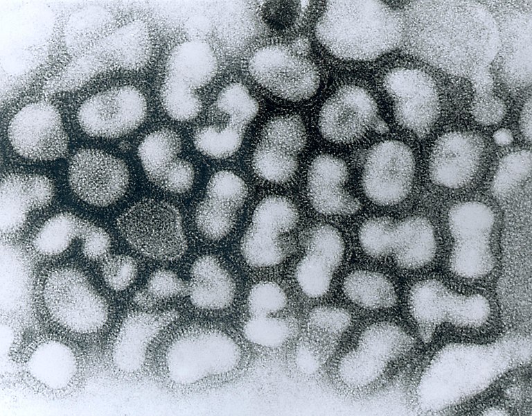 Fil:Influenza A - late passage.jpg