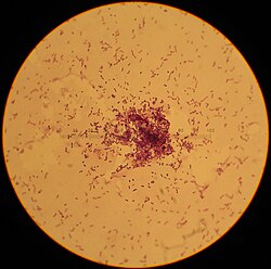 Streptococcus lactis.jpg