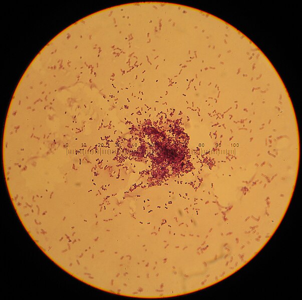 Fil:Streptococcus lactis.jpg