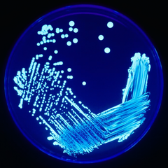 Legionella sp. under UV-bestrålning.