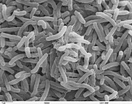 Kolerabakterien, Vibrio cholerae, sedd genom ett svepelektronmikroskop