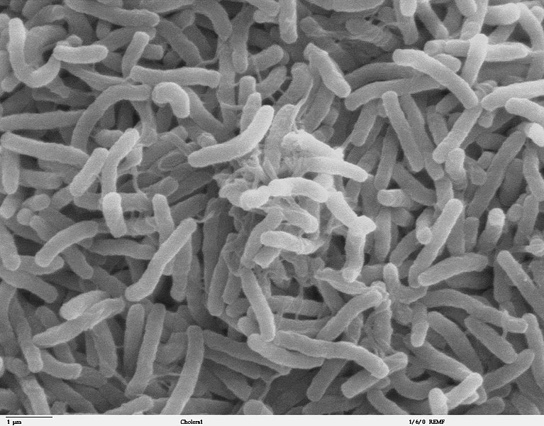 Fil:Cholera bacteria SEM.jpg