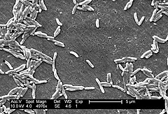 SEM micrograph of C. fetus