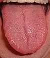 Fil:Tongue.agr.jpg
