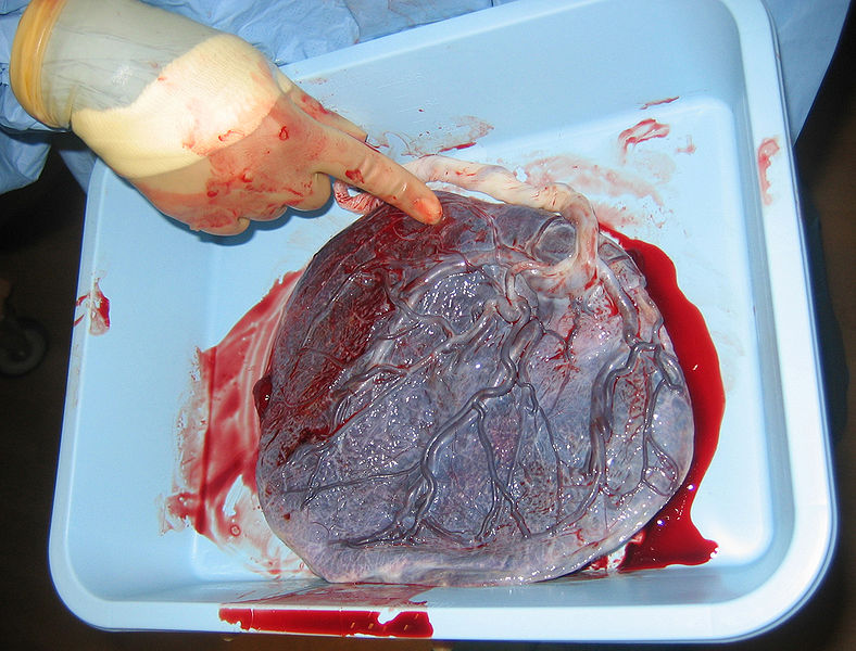 Fil:Human placenta baby side.jpg