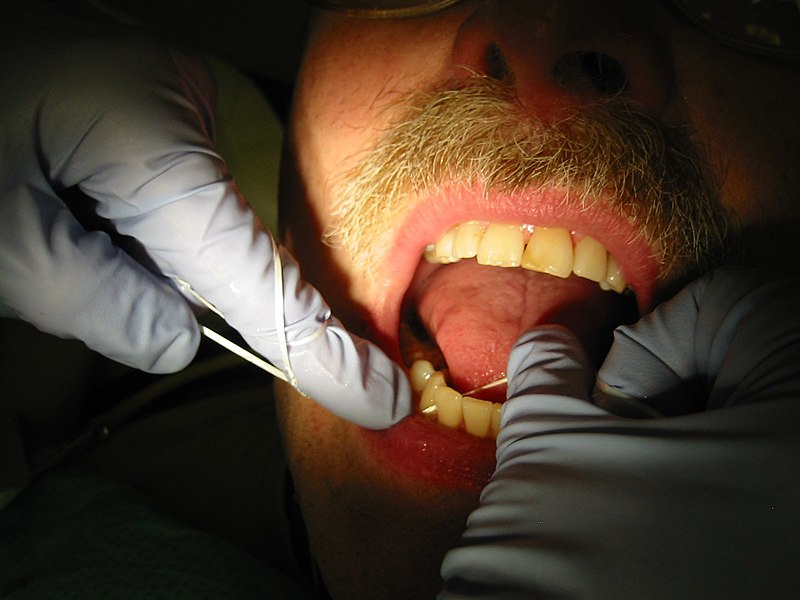 Fil:Dental flossing 9344.JPG