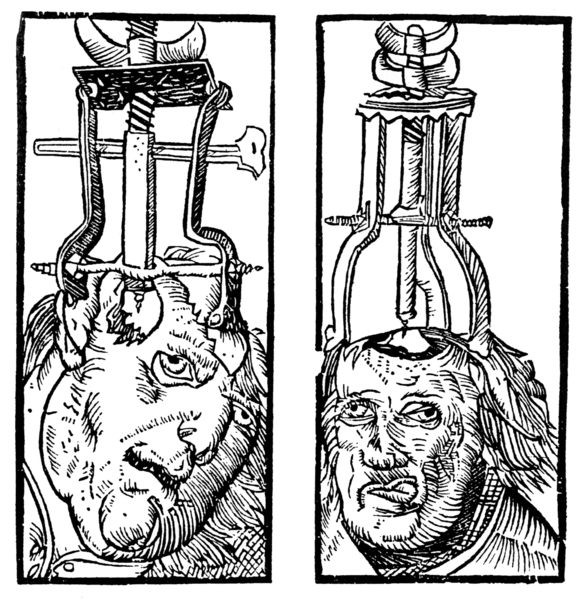 Fil:Peter Treveris - engraving of Trepanation for Handywarke of surgeri 1525.png