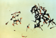 Clostridium tetani med karakteristisk utseende.