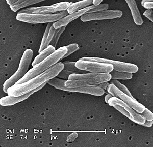 Fil:Mycobacterium tuberculosis.jpg