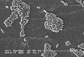 Elektronmikroskopsbild av Escherichia coli